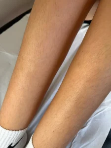 leg waxing 1